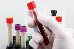 New Blood Test Identifies Biomarkers for Early Diagnosis of ALS, FTD, and PSP