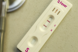 Q Fever and HIV Coexistence: An Overlooked Health Threat in the Homeless Population