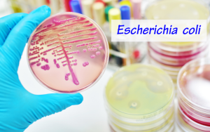Impact of Non-Antibiotic Medications on Antimicrobial Resistance Emergence in Escherichia Coli