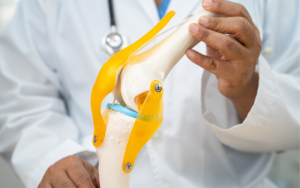 Effectiveness of Implementation Strategies for Group-Based Physical Therapy in Veterans with Knee Osteoarthritis