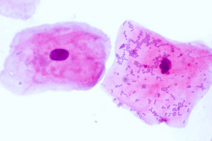 From Cancer Marker to Healer: The Regenerative Role of SerpinB3