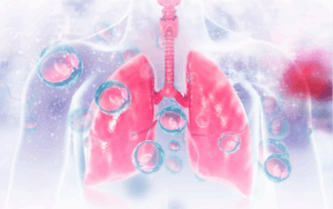 Lab-Grown Lung ‘On a Chip’ Sheds Light on Tuberculosis’s Earliest Attacks