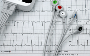 Rapid 4D Cardiac MRI Rendering for Integrated Valve and Myocardial Assessment