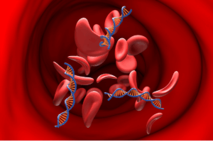 Game-Changer in Blood Cancer Care: ASH 2026 Updates AYA ALL Treatment Standards