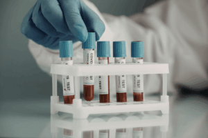 From Biomarker to Timeline: Blood Test Estimates Years Until Alzheimer’s Symptoms